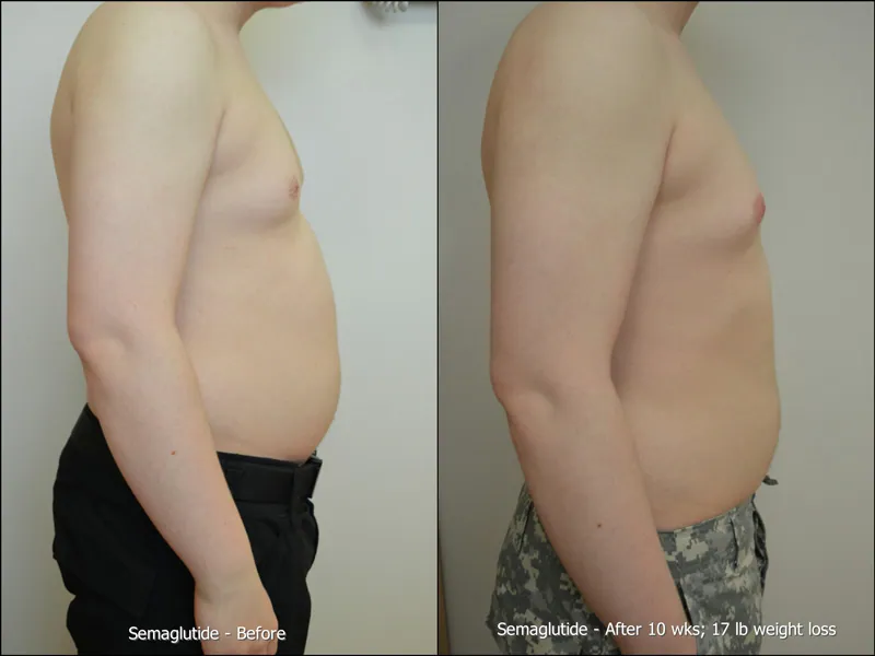 Before and After 1