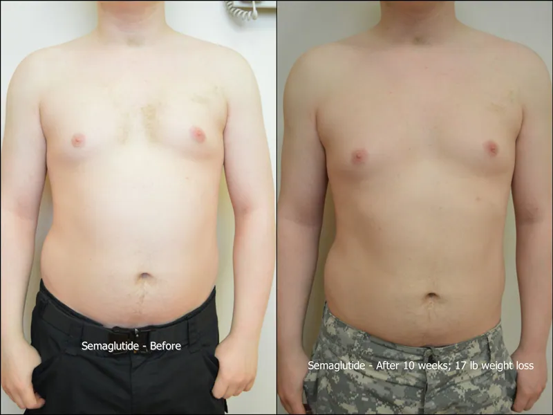 Before and After 5