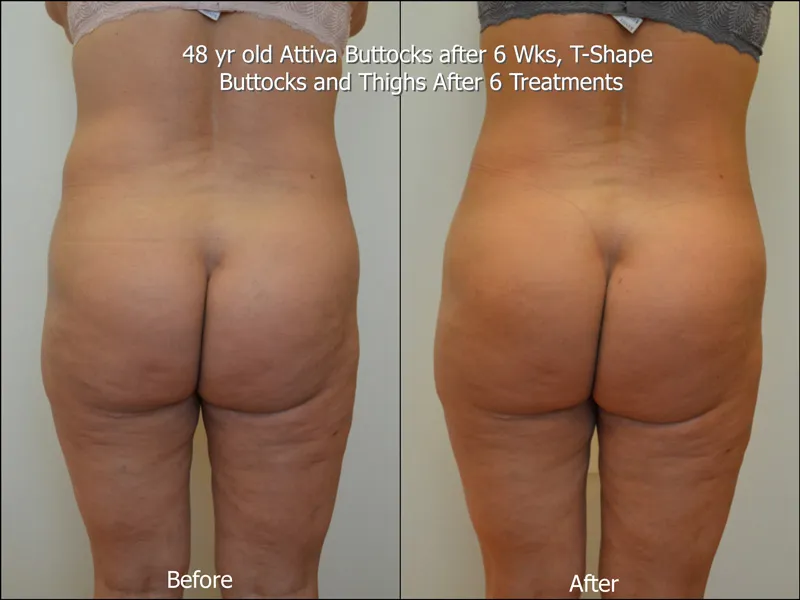 Before and After 7