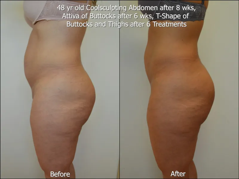 Before and After 8