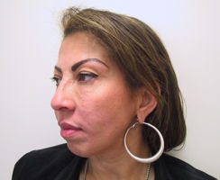 filler13b